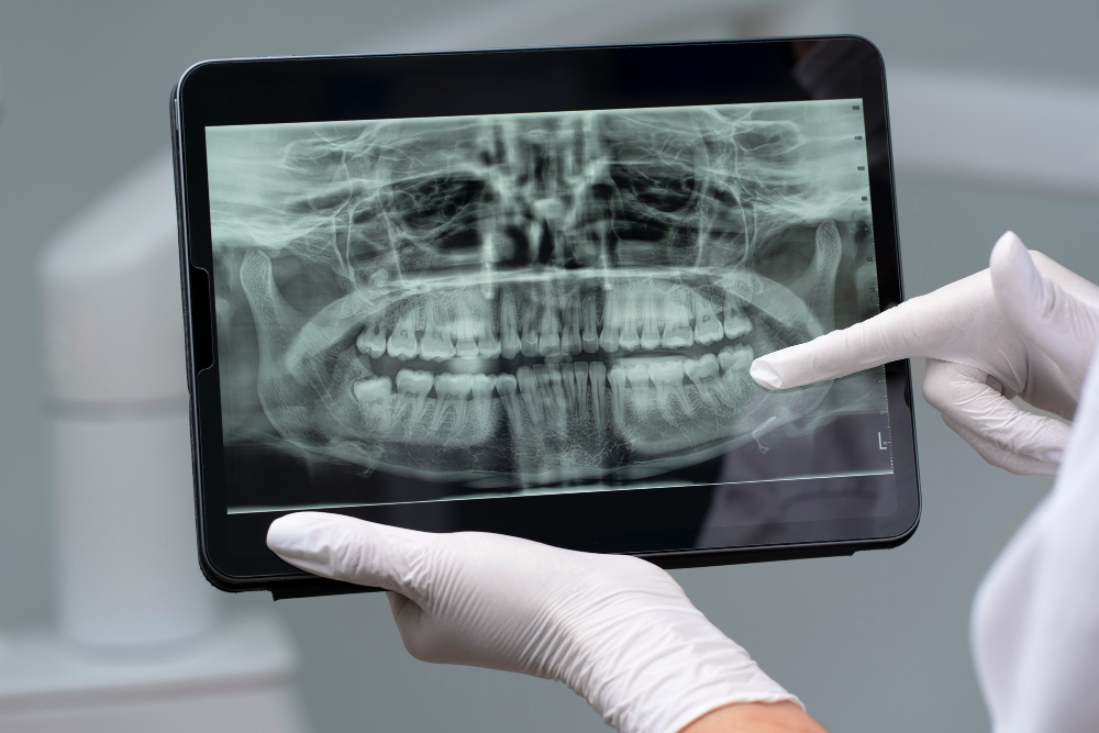 Digital X-Rays in Maumee
