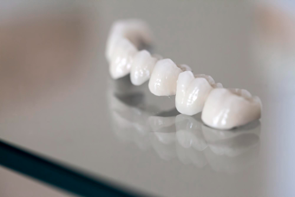 Porcelain Crowns in Maumee